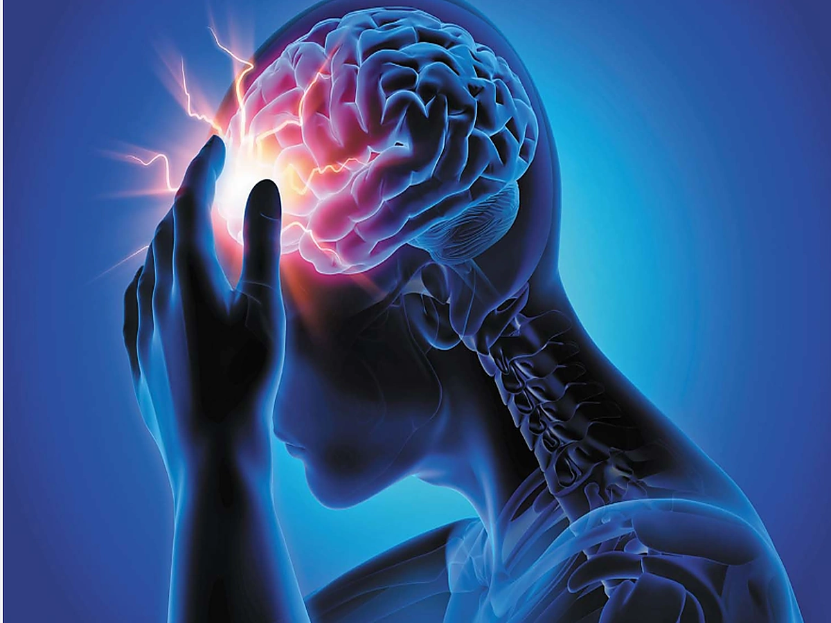 Medical illustration representing headache and migraine symptoms